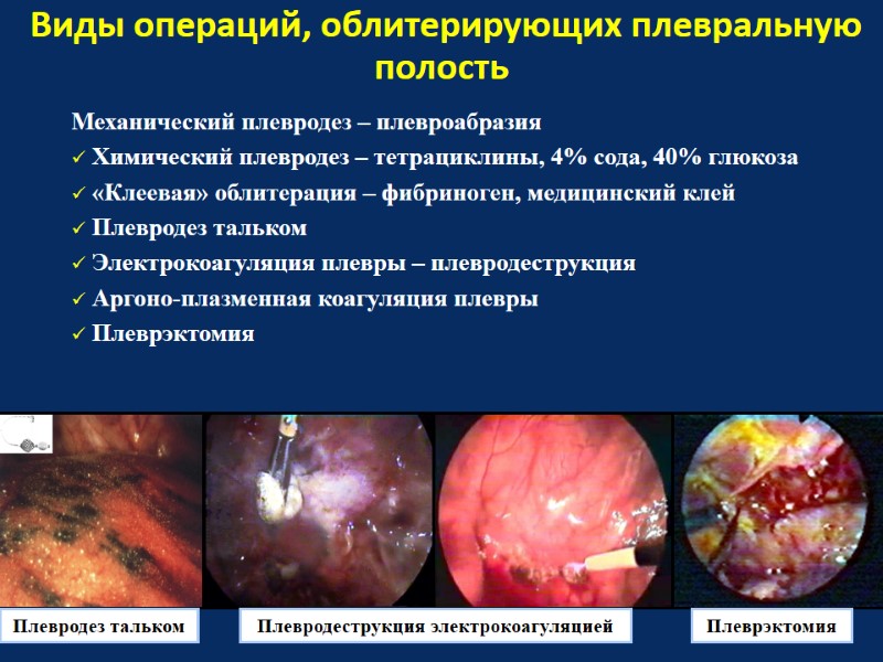 Виды операций, облитерирующих плевральную полость Механический плевродез – плевроабразия  Химический плевродез – тетрациклины,